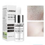 سرم جمع كننده منافذ باز لانبنا