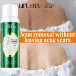 اسپری ضدجوش بدن